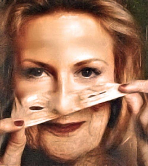 Laser Therapy Wand: Acne - Hair Loss - Celluite - Wrinkles - Look younger in minutes! DONT MISS OUT!