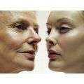LLLT LT Wand: Acne - Hair Loss - Celluite - Wrinkles - Look younger in minutes! DONT MISS OUT!