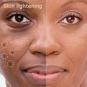 Skin - lighteners - creams