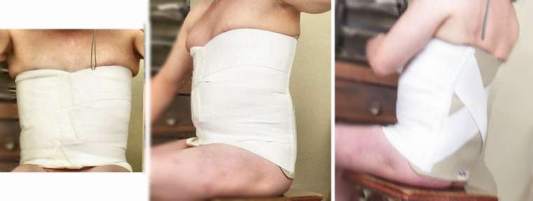 Abdominal corset