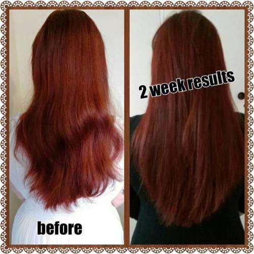 NuLengths Platinum Hair Growth Treatment