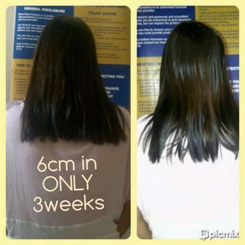 NuLengths Platinum Hair Growth Treatment