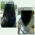 Grow Thick, Long, Beautiful Hair - Platinum Hair Growth Treatment - Stop Hair Loss