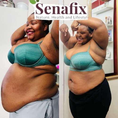 Senafix