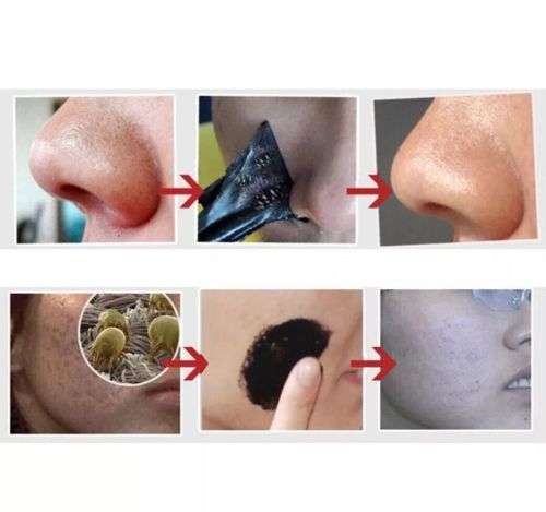 Blackhead Remover  SHILLS Purifying Black Peel-off Mask, Deep Cleansing 50ml