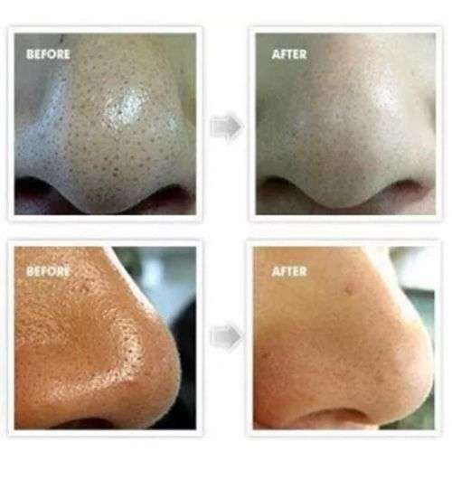 Blackhead Remover  SHILLS Purifying Black Peel-off Mask, Deep Cleansing 50ml