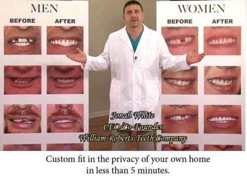 Perfect Smile Top Teeth Veneers Denture Paste Teeth Flex Fit Press on Veneers Covers