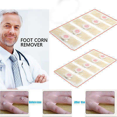 10pc Medical  Corn Plaster Plantar Wart  Removal Foot Care Relief