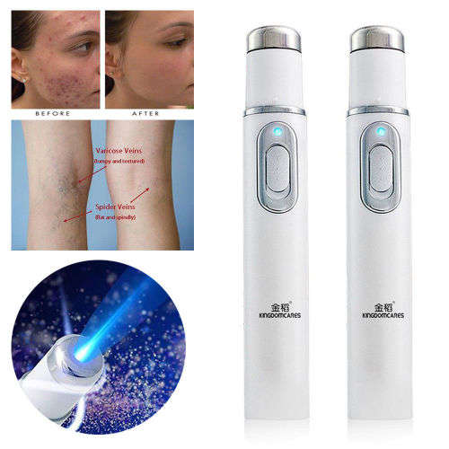 Blue Light Therapy Laser Pen Varicose Vein/ Scar / Acne/ Wrinkle Removal Treatment