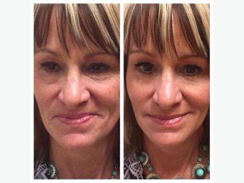 Instantly Ageless - Take off 10 years in just 3 minutes!!