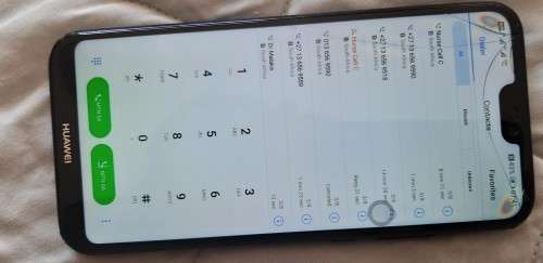 P20 lite --please read