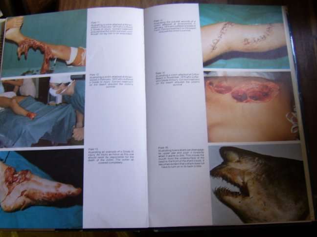 WALLETT, Tim - Shark Attack In Southern African Waters & Treatment of Victims - (H/C in Wrapper)