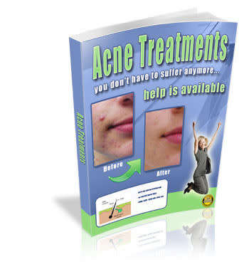 acne treatment