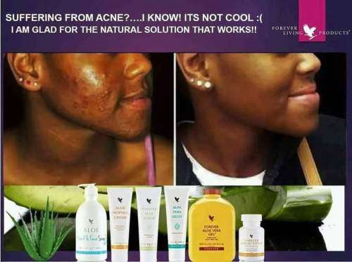 FOREVER LIVING ACNE KIT
