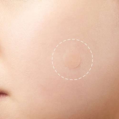 COSRX Acne Pimple Master Patch, 24 Patches