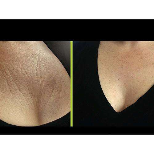 Bravity Women Anti-Wrinkle Cleavage Sleep Bra/Seamless & Adjustable-M