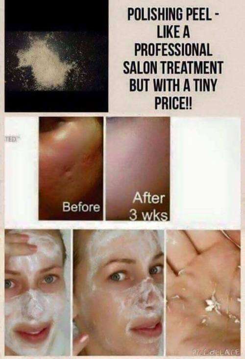 POLISHING PEEL SKIN REFINISHER