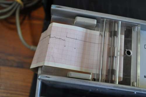 Vintage Siemens ECG Machine