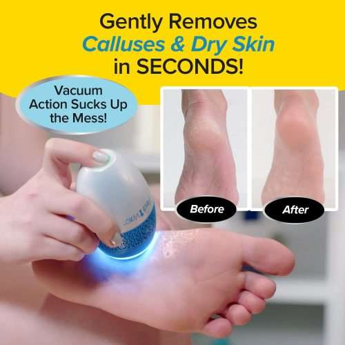 Foot Callus Remover with Built-in Vacuum Function Remove Dead Skin from Feet - Electric Callus Remov