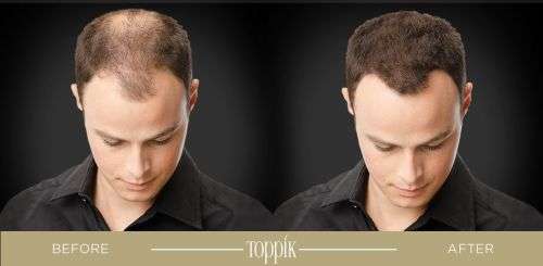 Toppik Hair Building Fibers - Black, Dark Brown, Medium Brown, Light Brown, Light Blonde - 27.5g