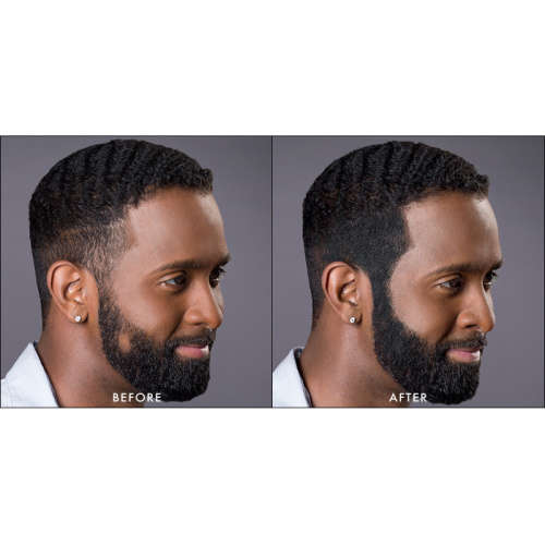 Toppik Hair Building Fibers - Black, Dark Brown, Medium Brown, Light Brown, Light Blonde - 27.5g