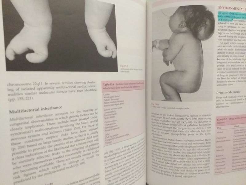 Emery`s Elements of Medical Genetics (R Mueller, I Young)