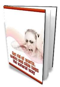 Get Rid Of Warts, Moles & Skin-Tags The Natural Way