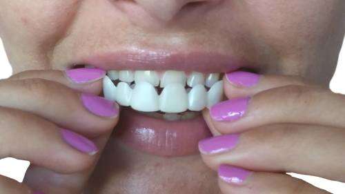 Artificial Teeth