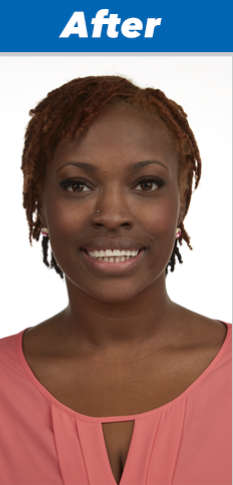 Artificial Teeth