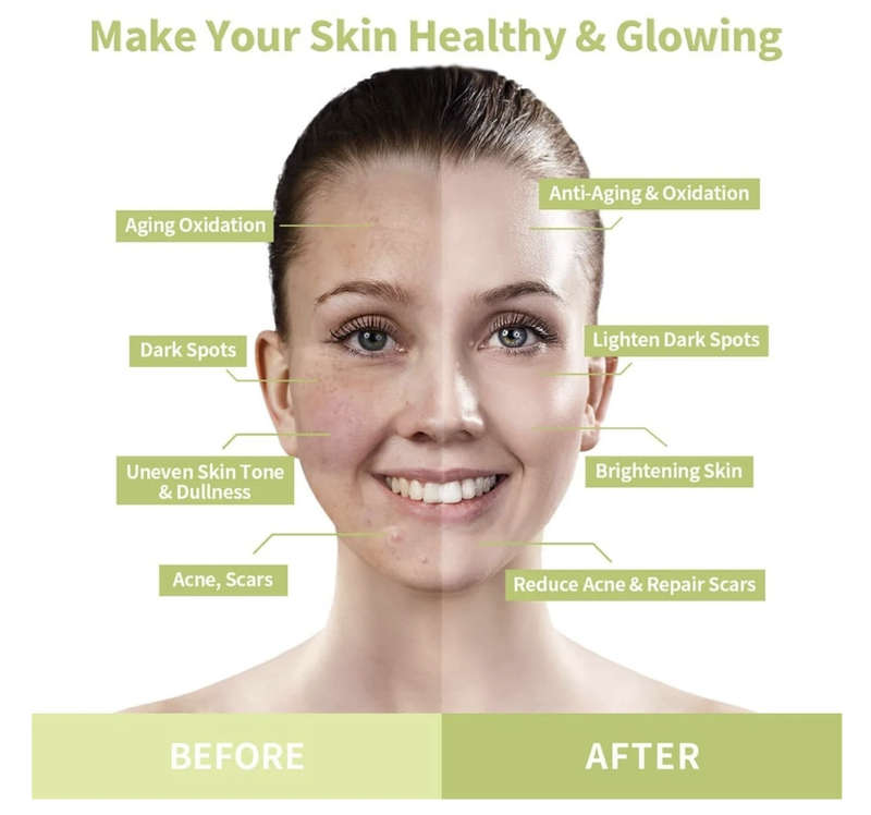 Green Tea Blackhead Removal Cream