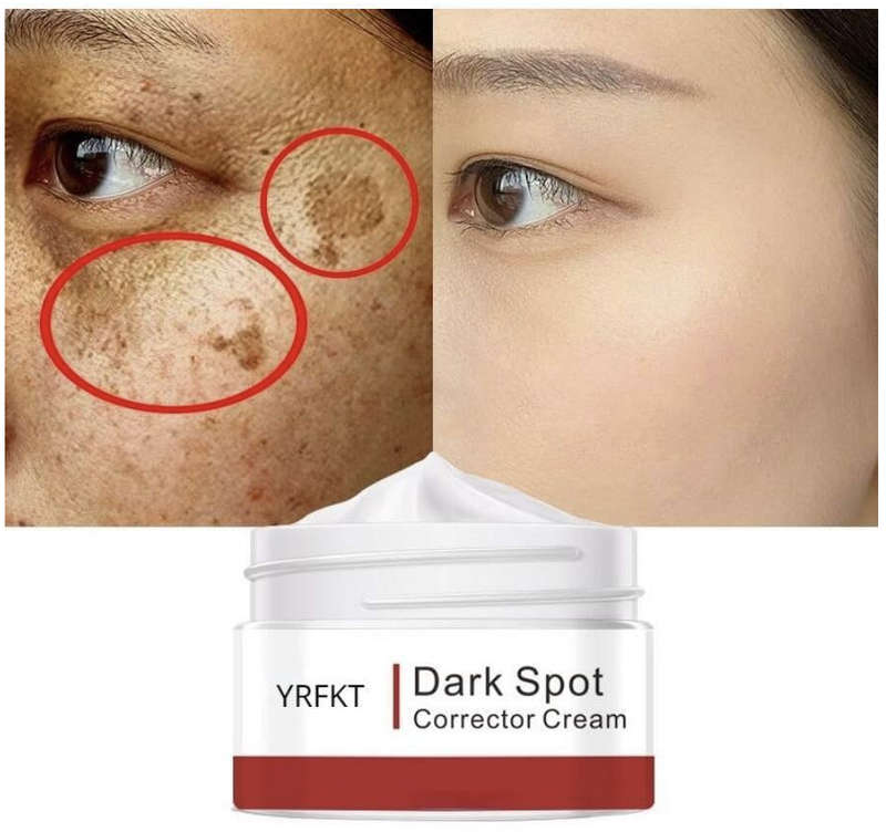 Whitening Cream