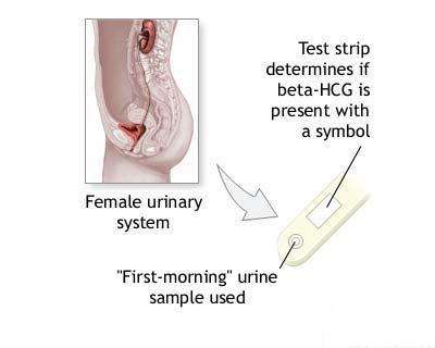 SELF TESTING PREGNANCY TEST *** 100% Accurate