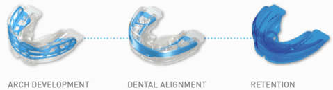 Sleeping Braces  Align your Teeth and improve your Jawline and Face Structure Step 1