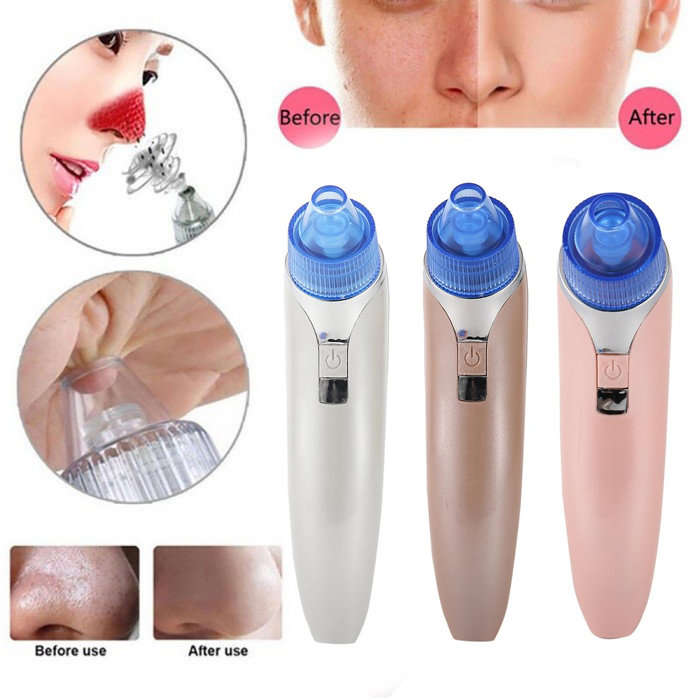 Blackhead Removal & Acne Vacuum Pore Cleaner