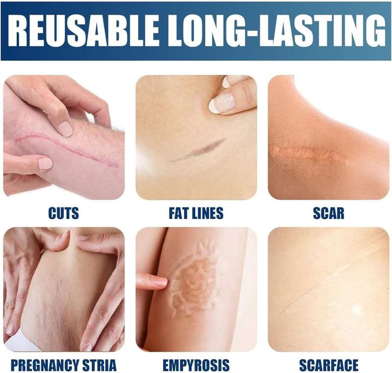 Advanced Silicone Scar Gel