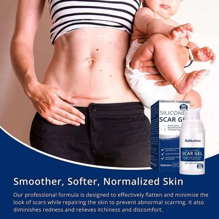 Advanced Silicone Scar Gel