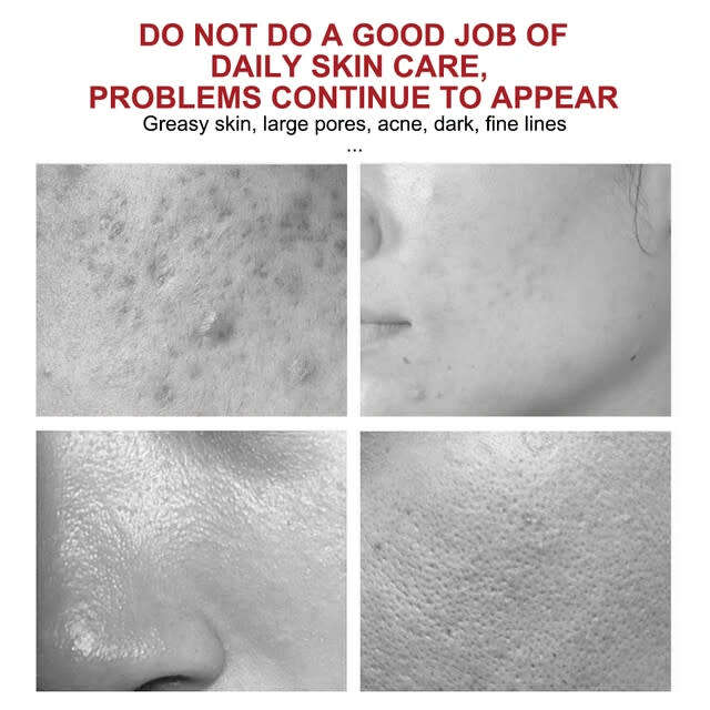 Lanemay Koji Acid Face Cream with Retinol