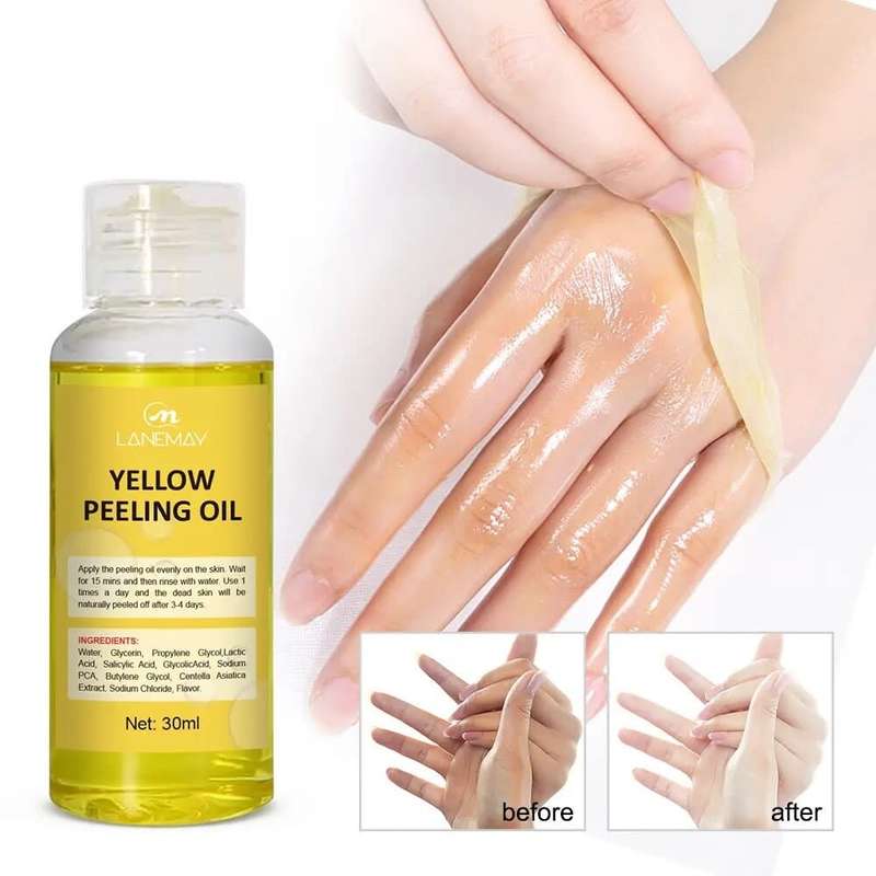 Lanemay Yellow Peeling Oil With Lactic Acid, Salicylic Acid & Glycolic Acid 30ml