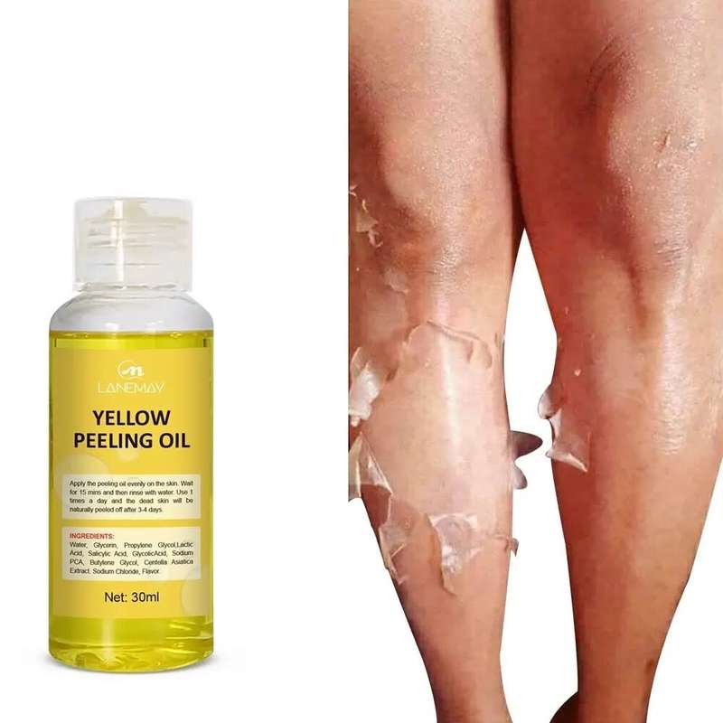 Lanemay Yellow Peeling Oil With Lactic Acid, Salicylic Acid & Glycolic Acid 30ml