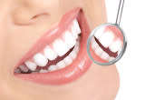 Dental Teeth Whitening Kit