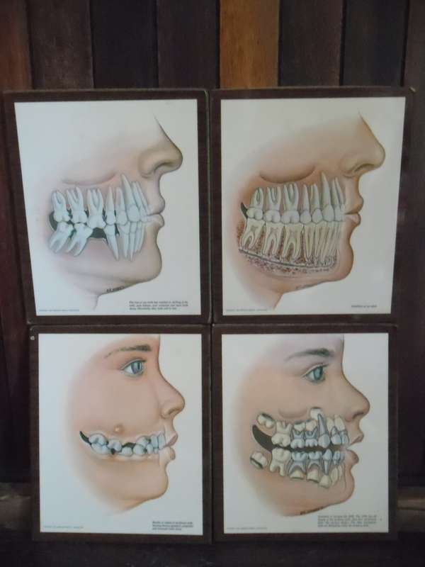 Set of 4  American Dental Association dental wall plaque displays. W R Schwartz. 1966