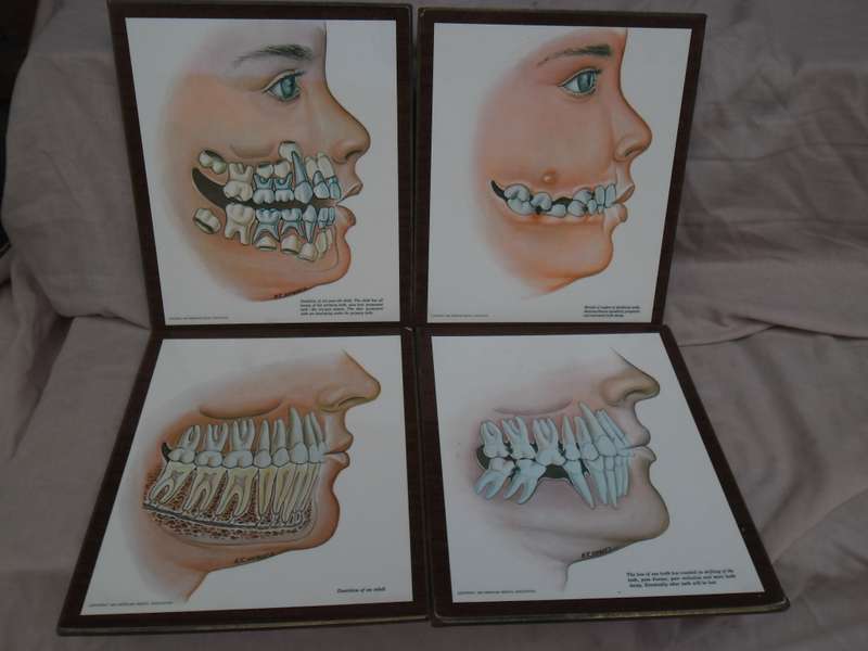 Set of 4  American Dental Association dental wall plaque displays. W R Schwartz. 1966