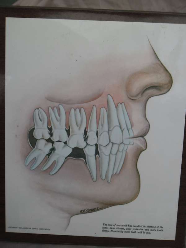 Set of 4  American Dental Association dental wall plaque displays. W R Schwartz. 1966