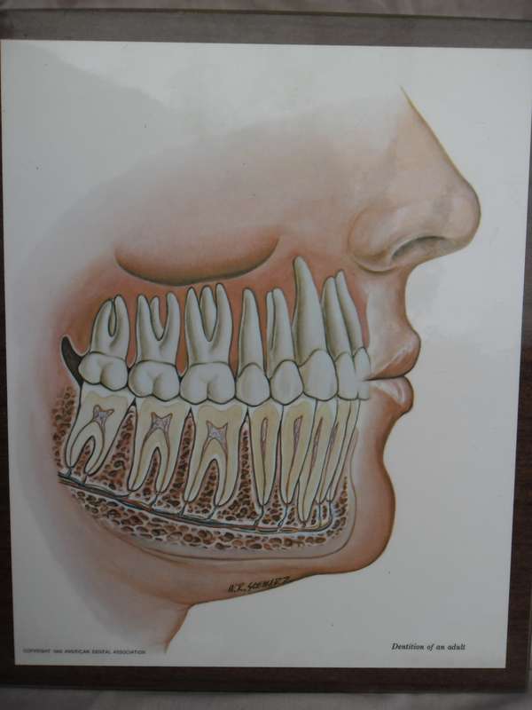 Set of 4  American Dental Association dental wall plaque displays. W R Schwartz. 1966