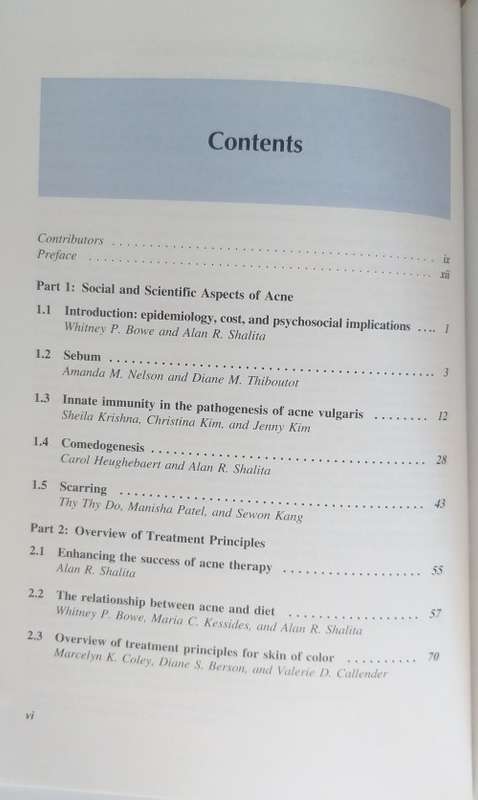 Acne Vulgaris : Alan R Shalita, James Q Del Rosso, Guy F Webster (Hardcover)