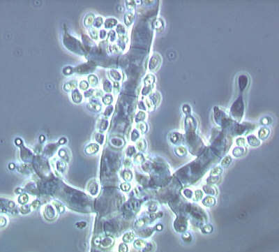 Trichoderma harzianum strain T22 Canna 1g, beneficial fungus for plant health (Free Post Option)