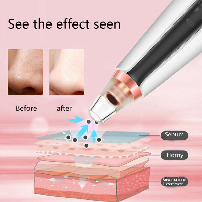 Electronic Blackhead Remover Pore Vacuum Cleaner with 6 Sucker Heads Unboxed