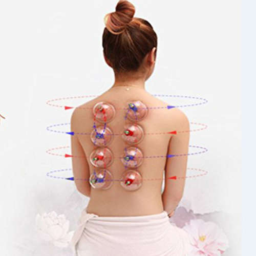 24 Cups Biomagnetic Vacuum Body Cupping Therapy Set Unboxed