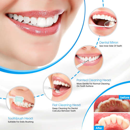 Electric Ultrasonic Dental Calculus Remover Dental Cleaning Device