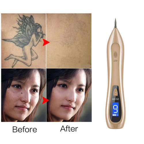 9 level LCD Face Skin Dark Spot Remover Mole Tattoo Laser Pen